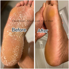 Load image into Gallery viewer, Celebrity Secret Exfoliating Foot Mask Socks to Repair Cracked Heels.