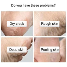 Load image into Gallery viewer, Celebrity Secret Exfoliating Foot Mask Socks to Repair Cracked Heels.