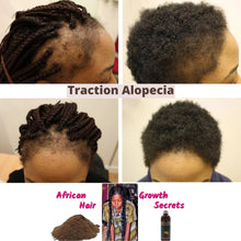 Load image into Gallery viewer, Miracle Hair Boost Extreme Natural Growth Oil 😳